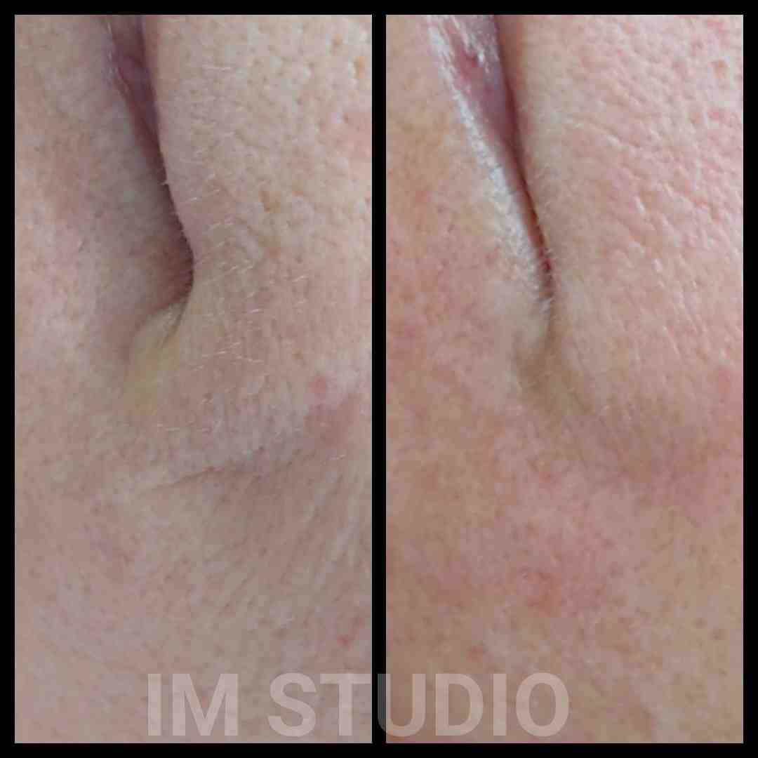 IM Studio