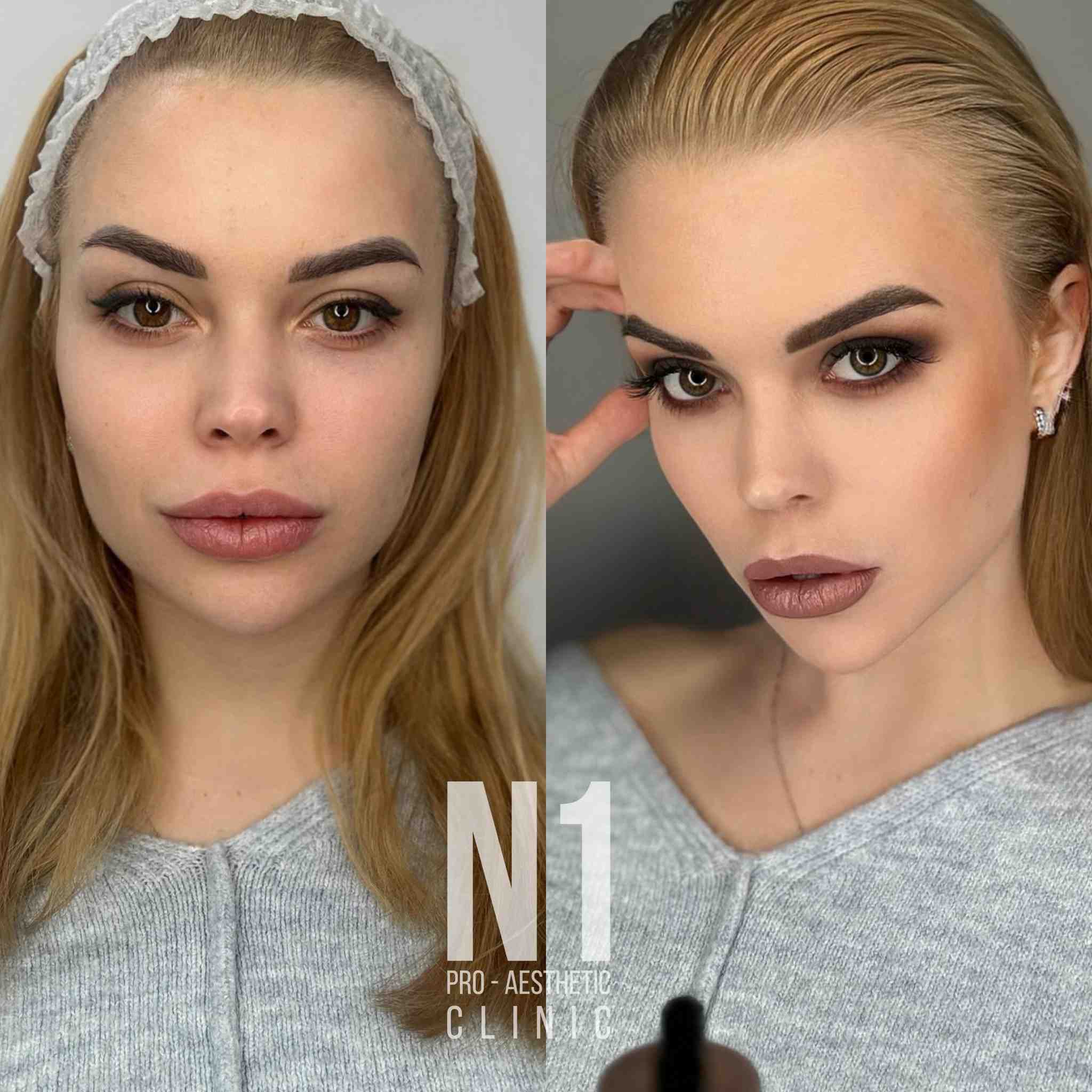 N1 Pro Aesthetic 
