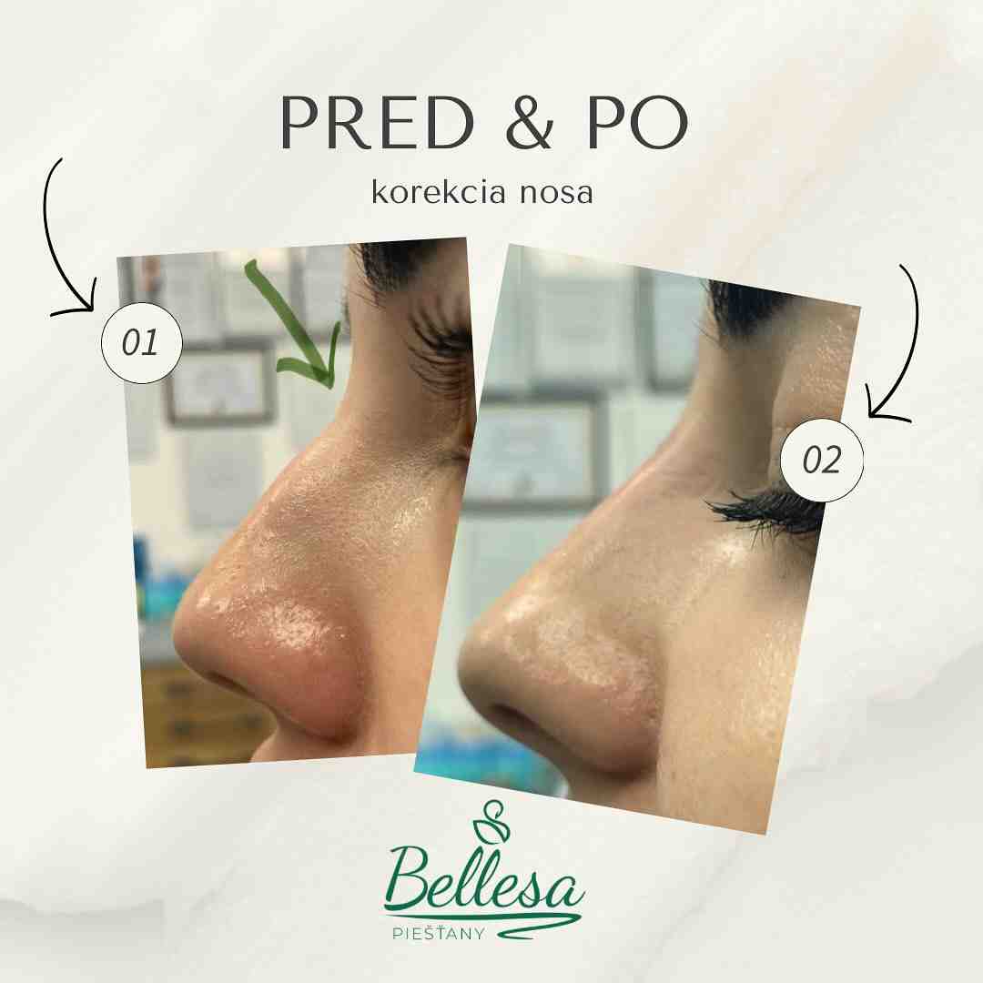 Bellesa Piešťany