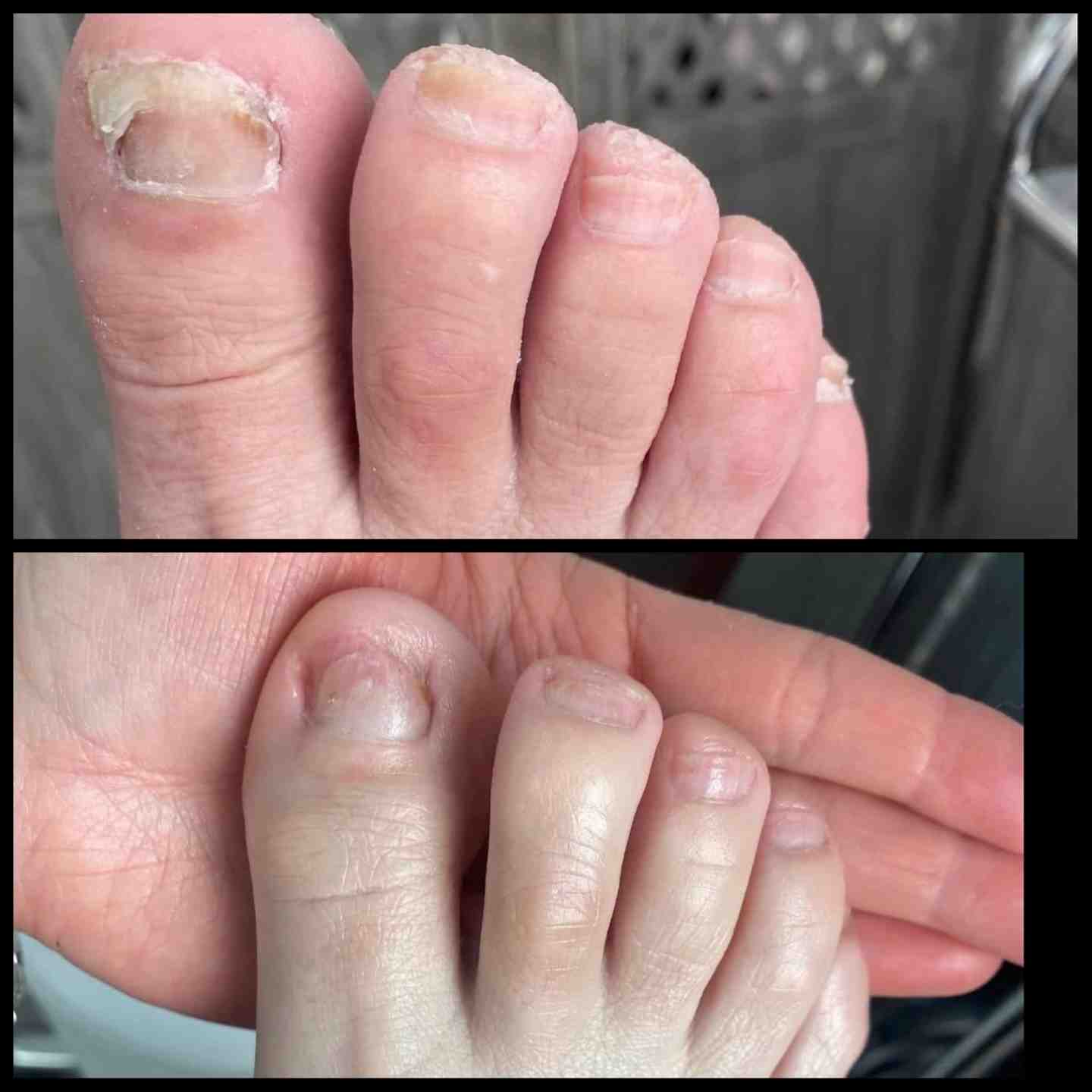 Beauty Bretlys