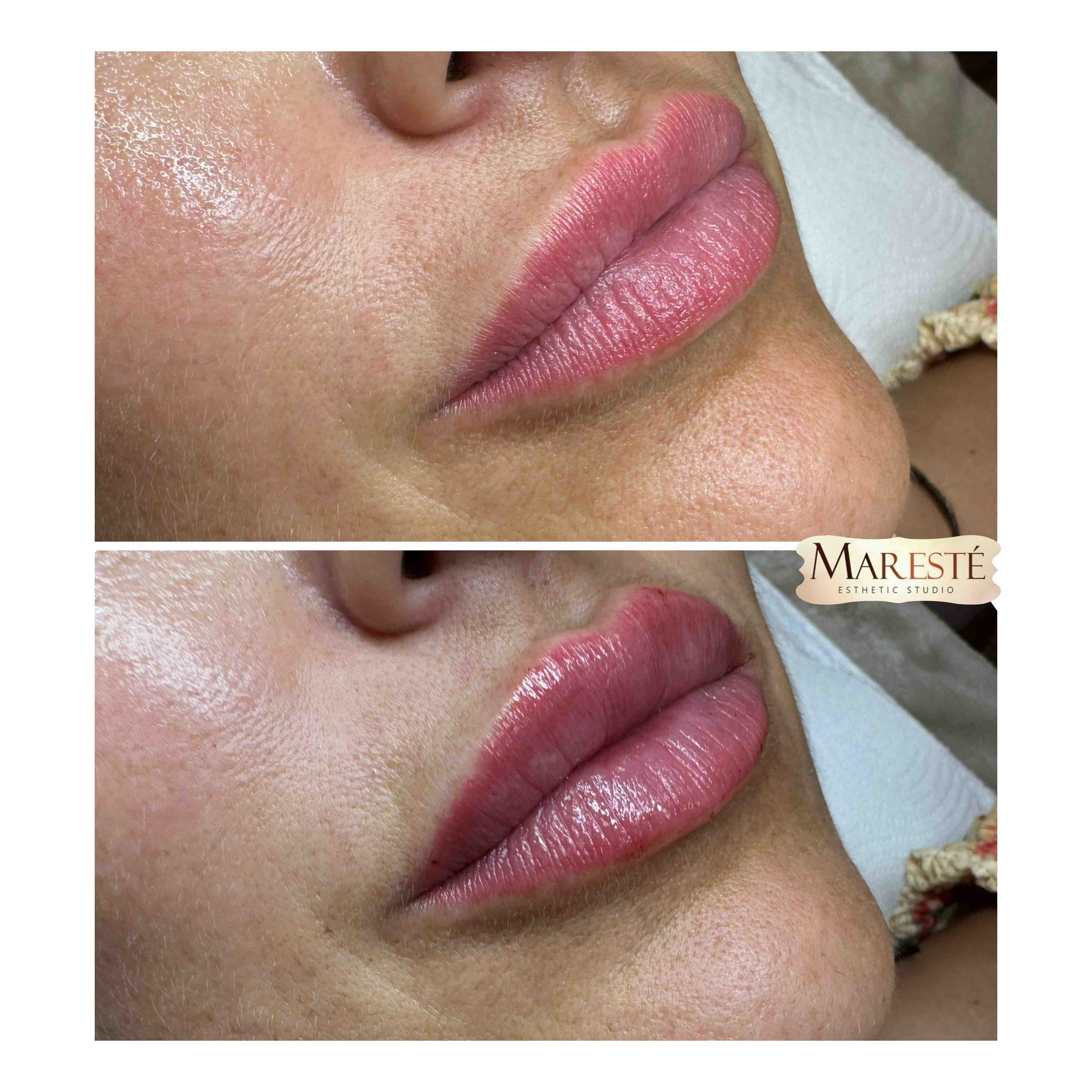 Maresté esthetic clinic
