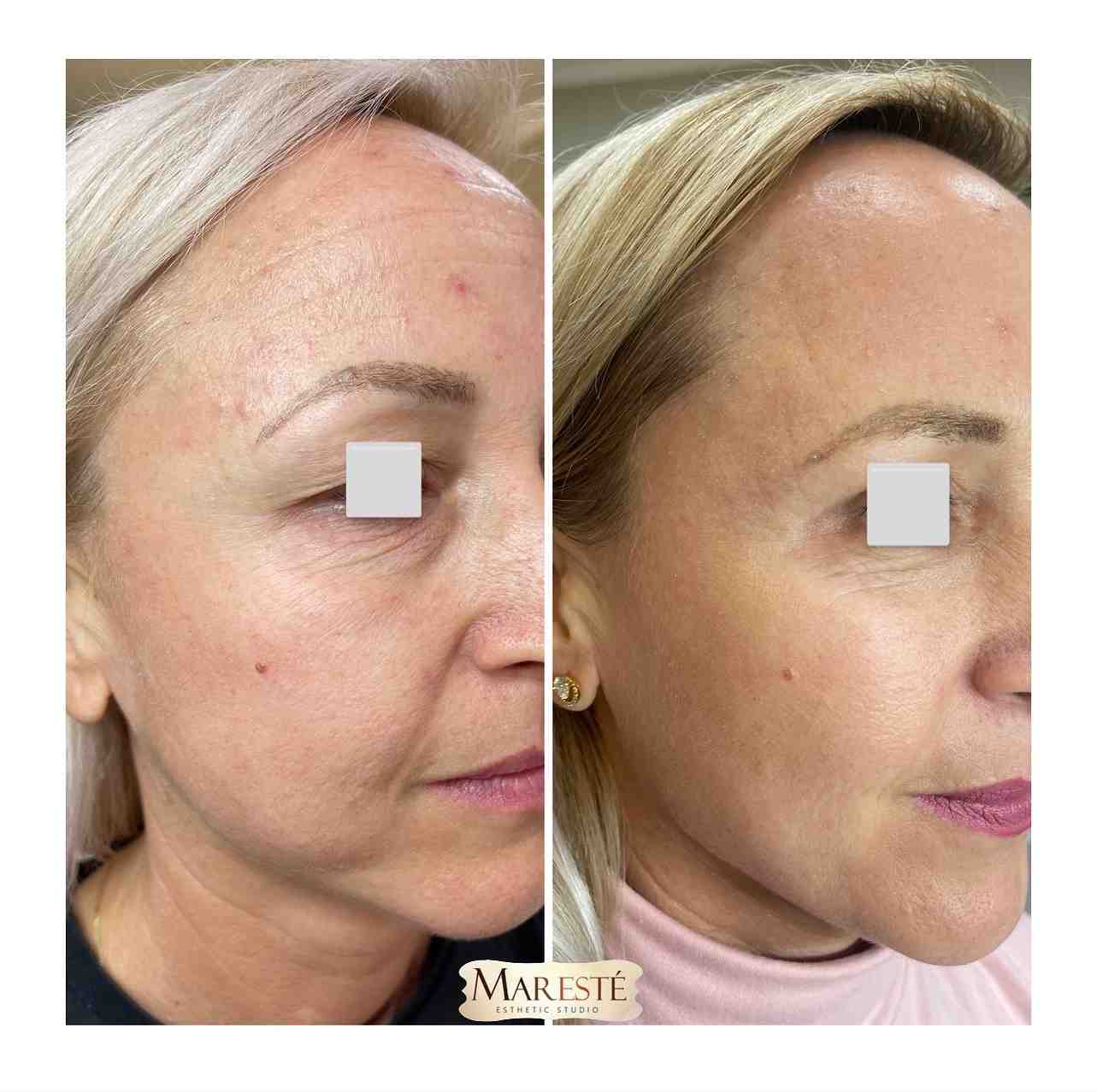 Maresté esthetic clinic