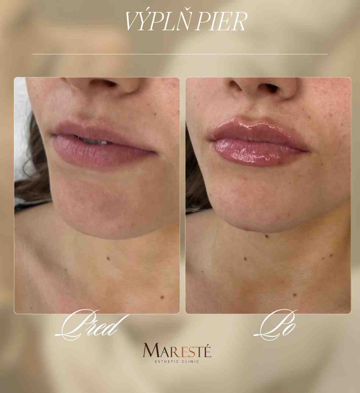 Maresté esthetic clinic