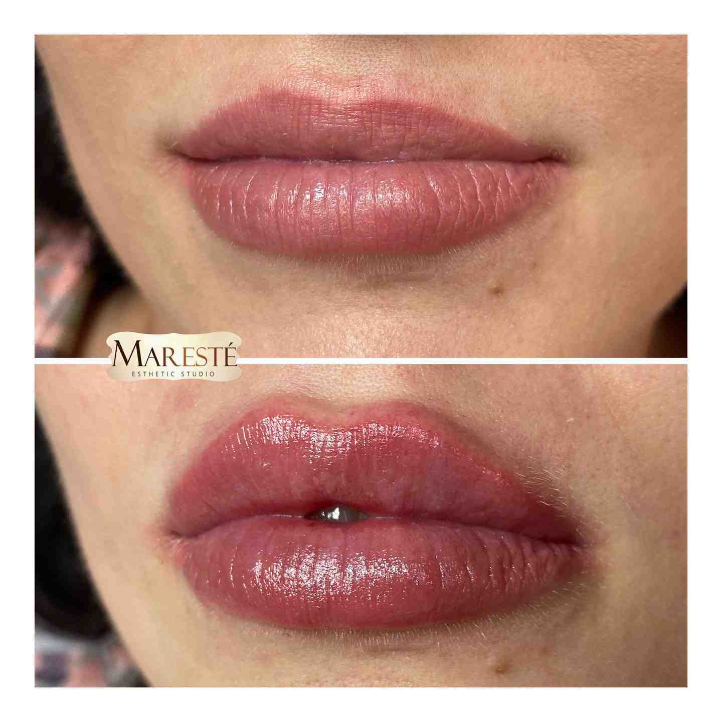 Maresté esthetic clinic