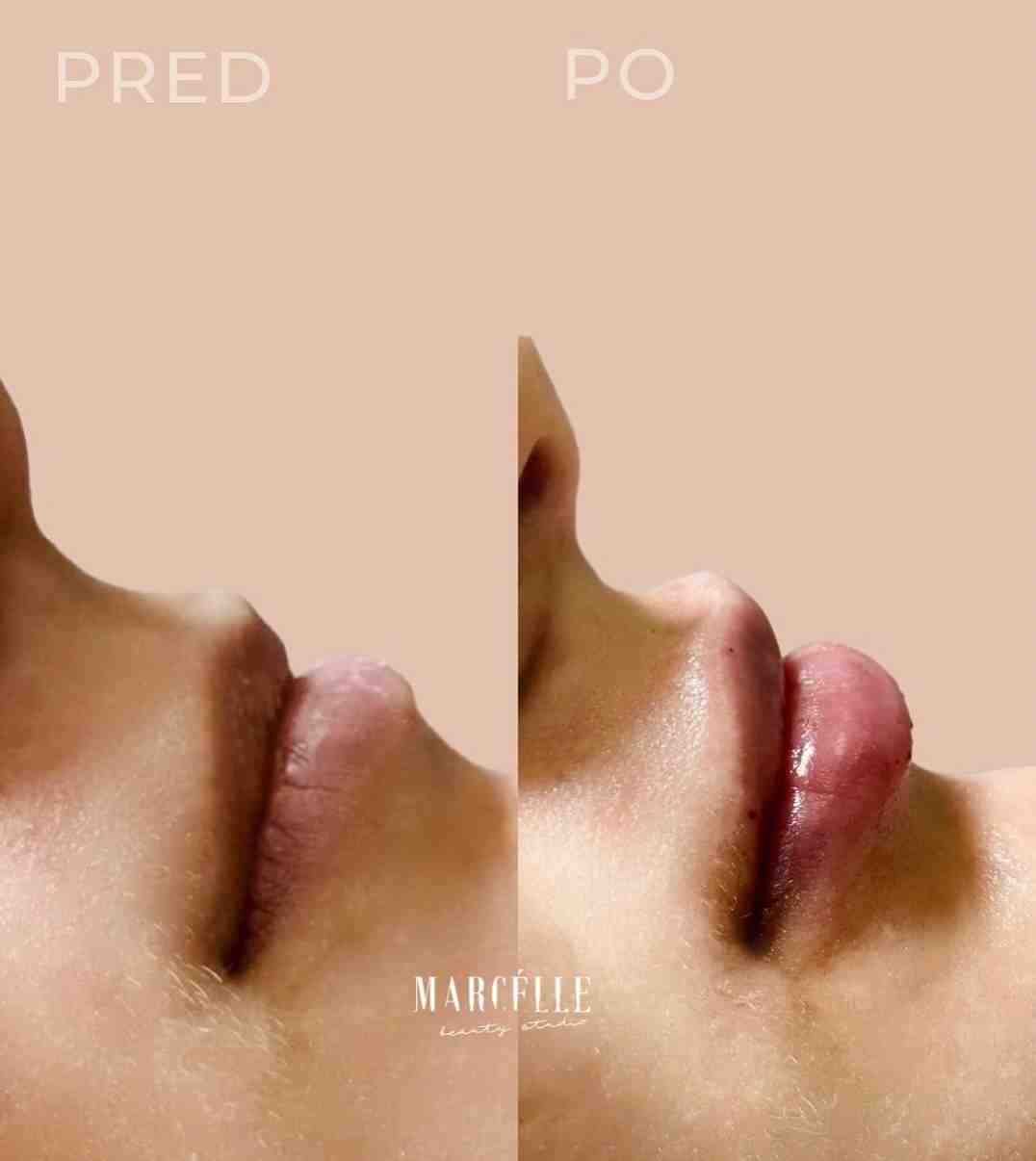 Marcélle Beauty Studio Košice
