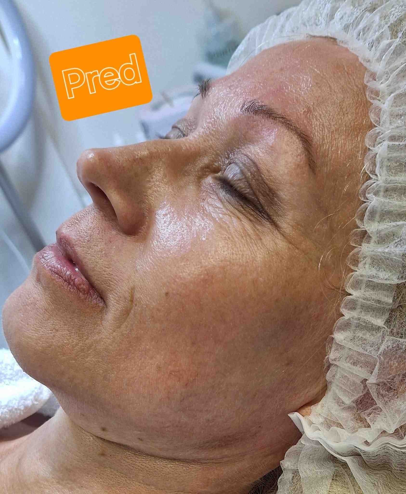 Beauty Therapy Ela