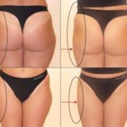 Body Slim